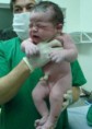 Parto de bebé com 5,2 kg surpreende médicos